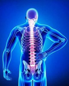 Is back pain hereditary LumbaCurve